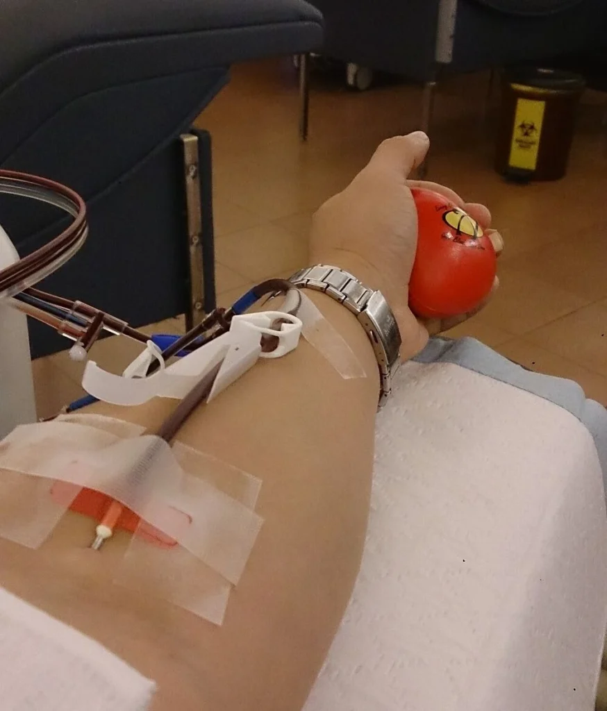 A donor giving platelets, squeezing a soft ball while the machine collects